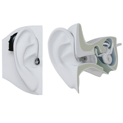 Ακουστικά βαρηκοΐας Resound με δέκτη στο αυτί (Receiver In Ear - RIE)